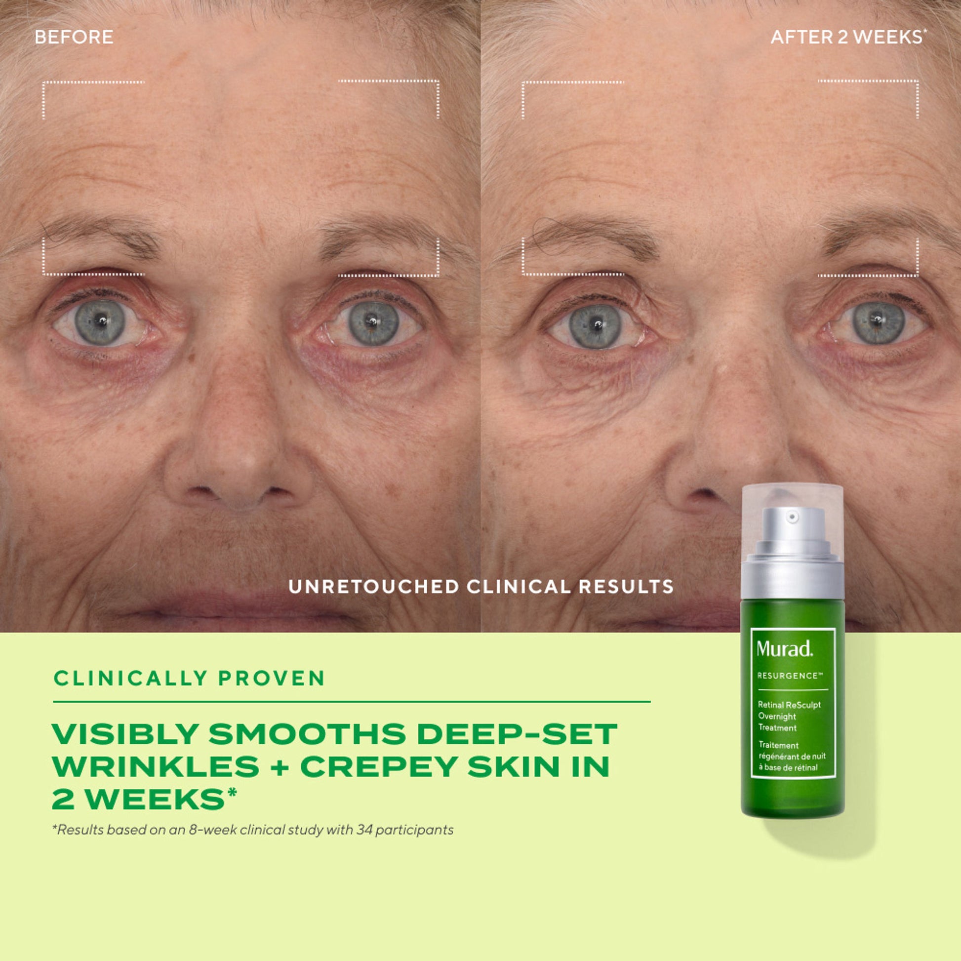 Murad Retinal ReSculpt Overnight Treatment