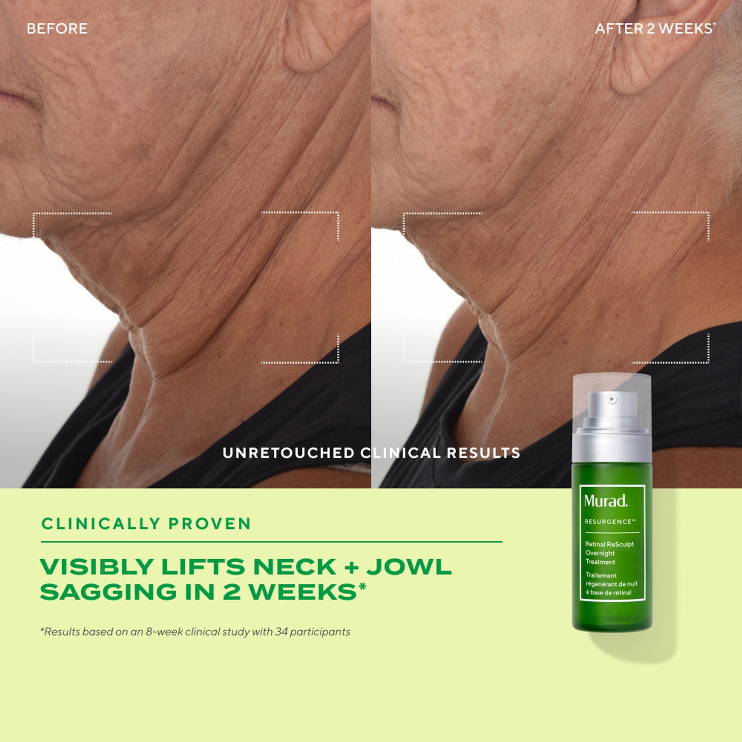 Murad Retinal ReSculpt Overnight Treatment