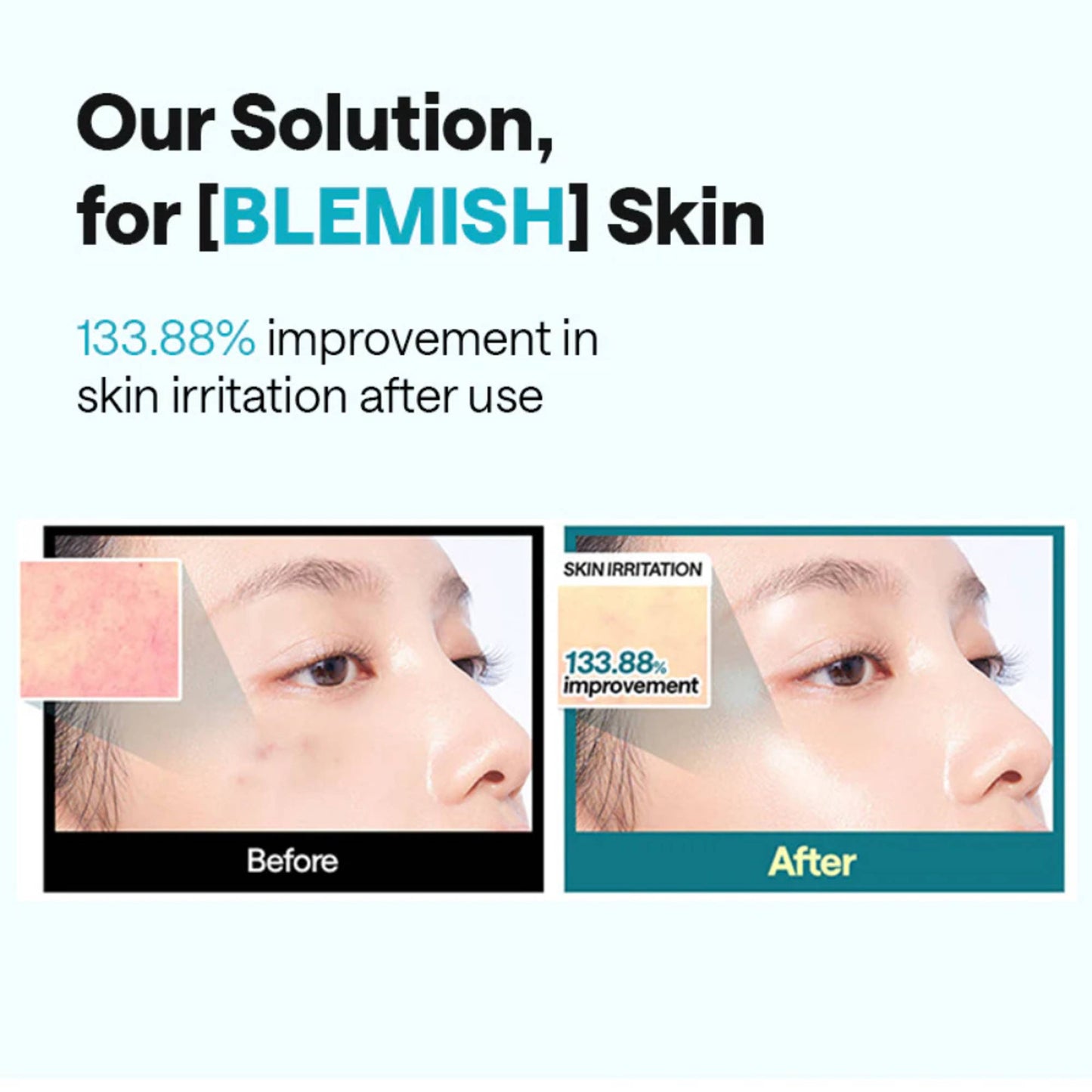 Mediheal Madecassoside Essential Mask