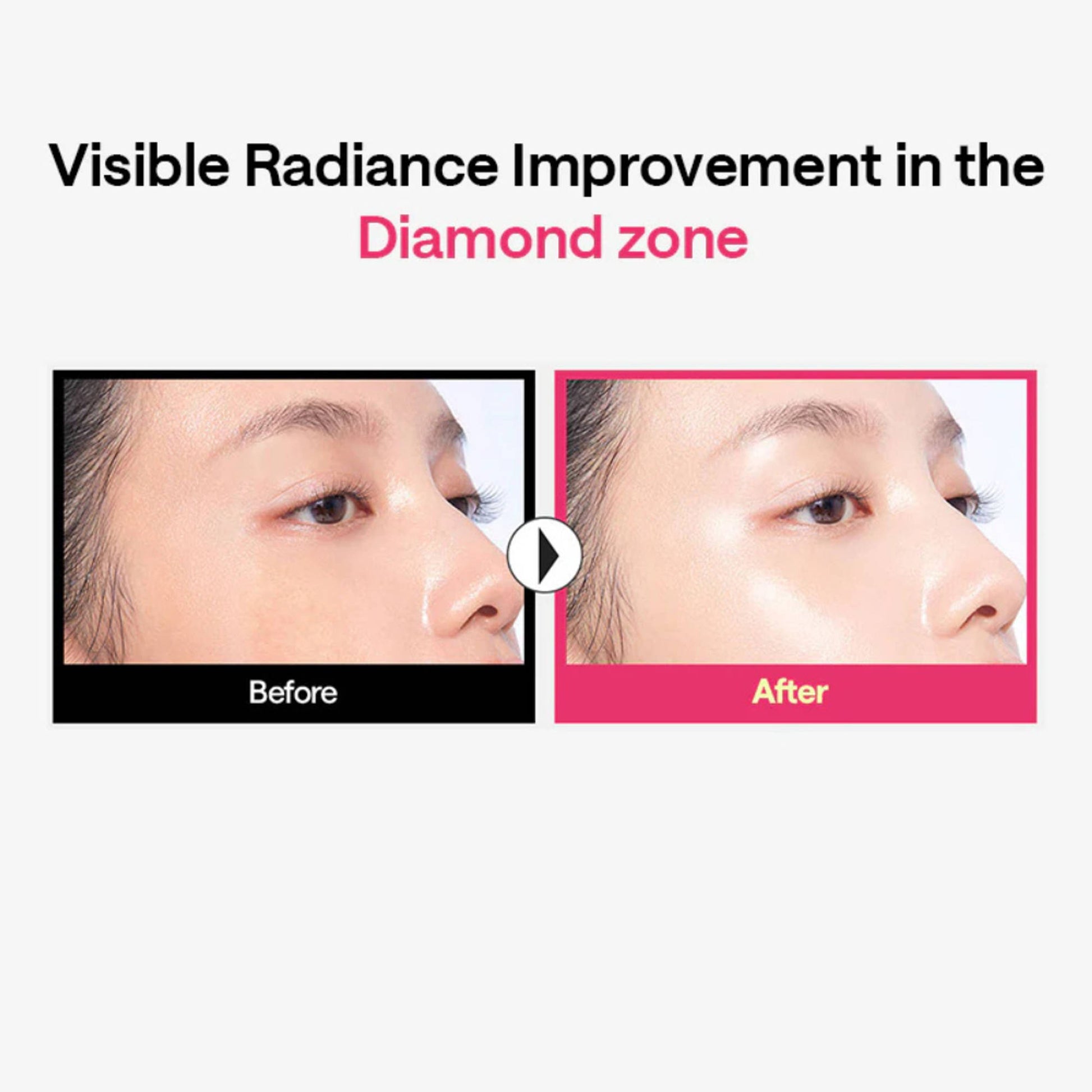 Mediheal Rose PDRN Essential Mask