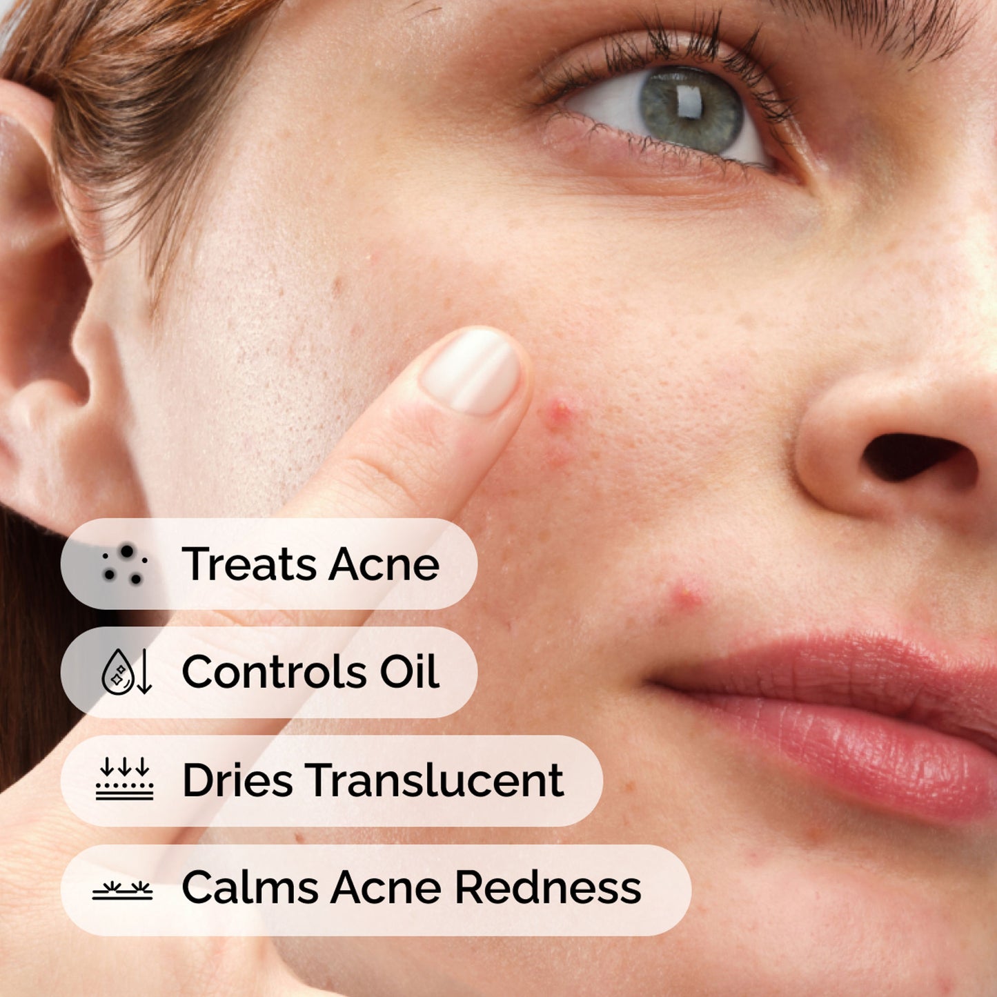 The Ordinary Sulfur 10% Powder-to-Cream Concentrate - Acne Spot Correction for Sensitive Skin