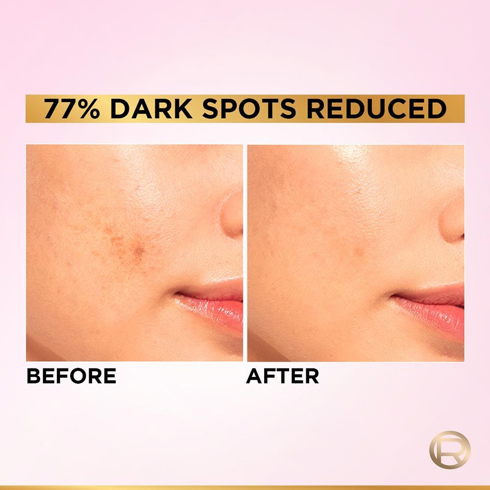 L'Oreal Paris Glycolic Bright 8% [Melasyl + Niacinamide] Face Serum For Brightening Dark Spots - Indyancart