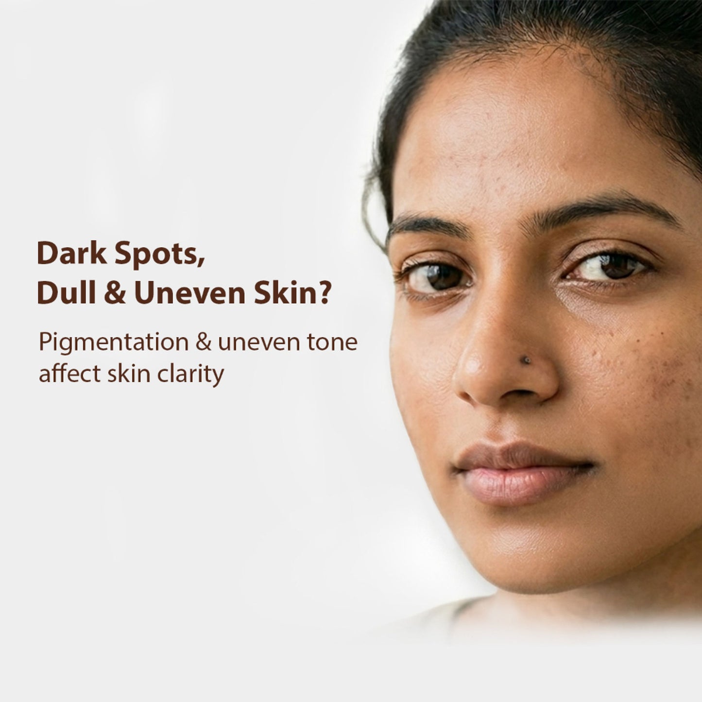 DERMISTRY Kojic Acid Face Cream Pigmentation Tan Removal Glowing Skin Whitening Lightening Fairness