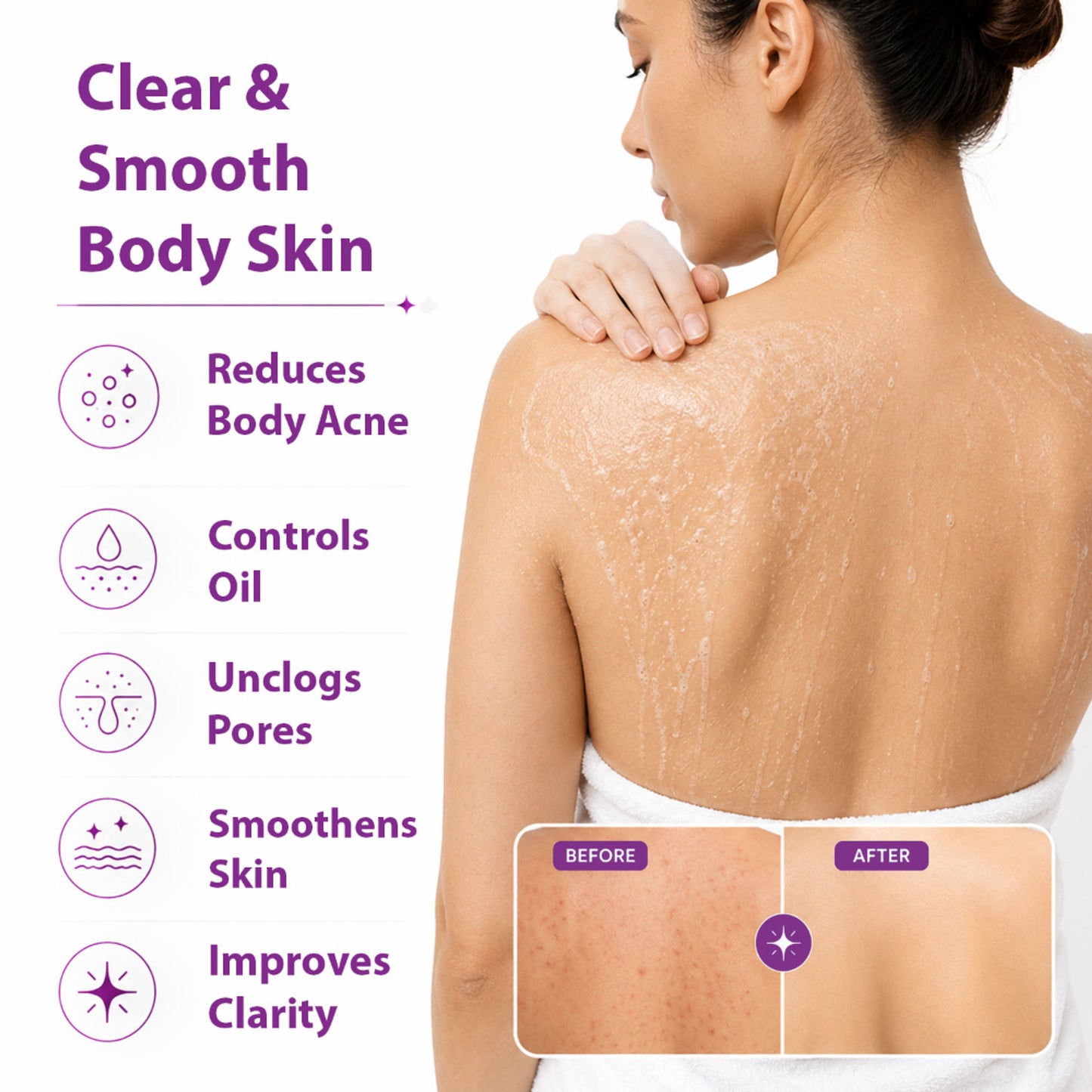 DERMISTRY 1% Salicylic Acid Niacinamide Exfoliating Body Wash for Back Acne Oily Acne Prone Skin