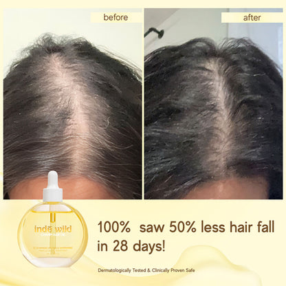 inde wild Champi Hair Oil With Bhringraj, Brahmi & Amla For Regrowth, Hairfall & Dandruff Control
