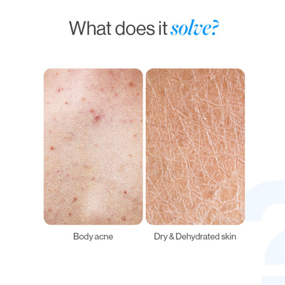 Be Bodywise 1% Salicylic Ceramide Body Wash - Dual Pump 2in1 Body Wash - For Body Acne and Dry Skin