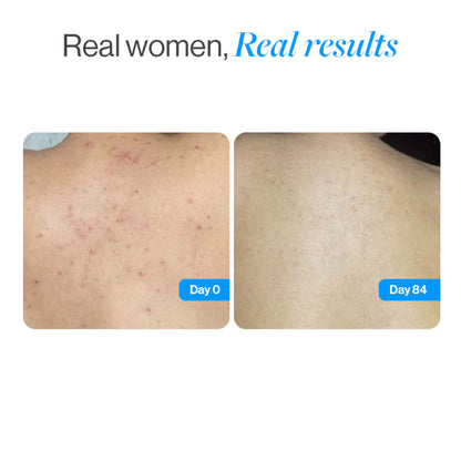 Be Bodywise 1% Salicylic Ceramide Body Wash - Dual Pump 2in1 Body Wash - For Body Acne and Dry Skin