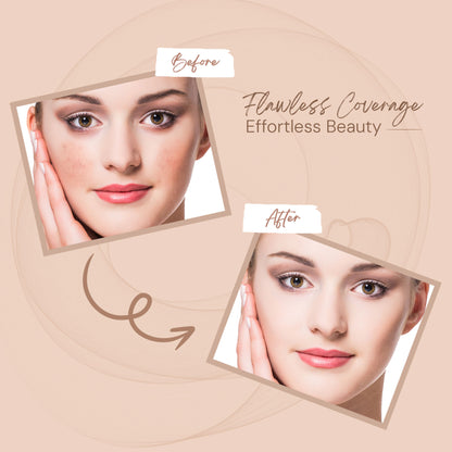 Shryoan Full Coverage and Lightweight Formula Spot on Concealer - 6