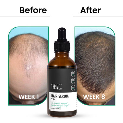 ThriveCo Hair Growth Serum 2.0 - Indyancart