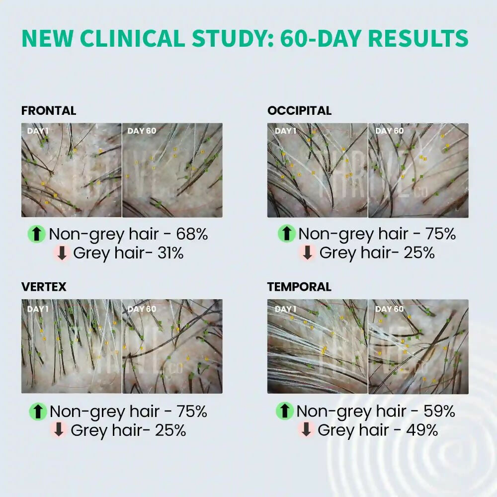 ThriveCo Anti-Greying Hair Prime Serum - Indyancart