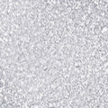 Silvers Parkle