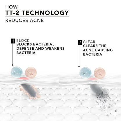 Novology Acne Reduction Serum With 0.1% Thymol + Terpineol - Indyancart