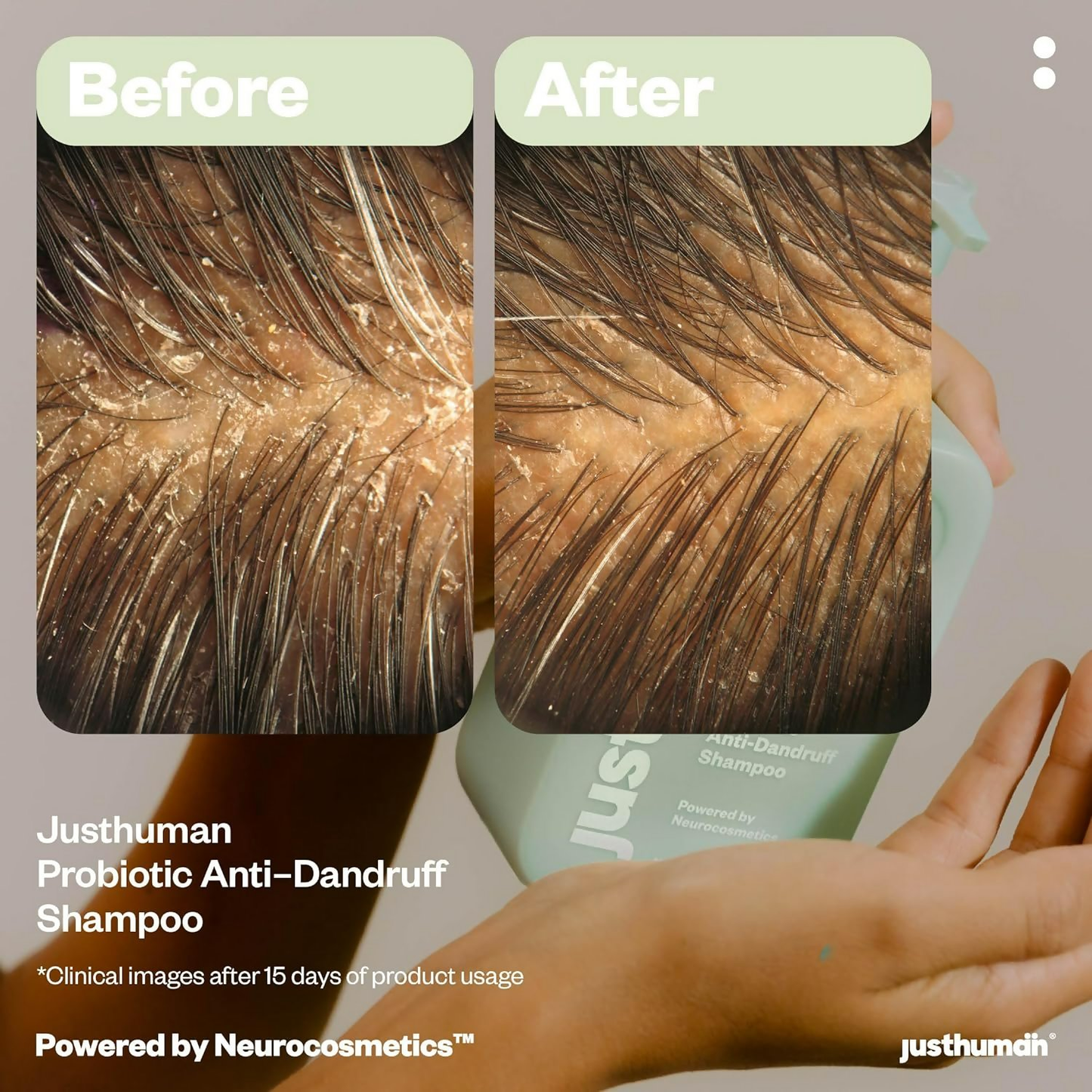 JustHuman Probiotic Anti Dandruff Shampoo bottle with label, showing its natural ingredients and clean design.