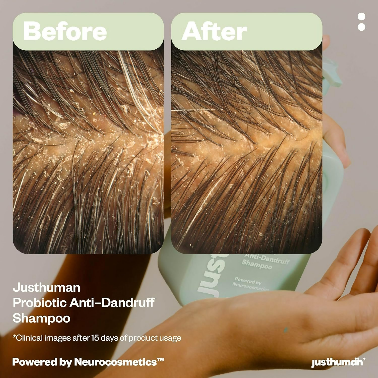 JustHuman Probiotic Anti Dandruff Shampoo bottle with label, showing its natural ingredients and clean design.