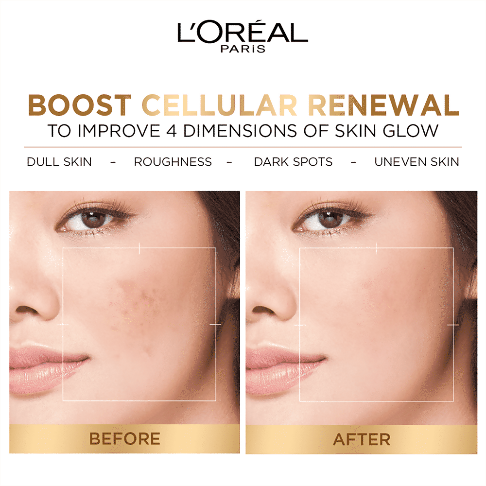 L'Oreal Paris Glycolic Acid skincare kit featuring a sunscreen, cleanser, serum, and moisturizer for glowing, protected skin.