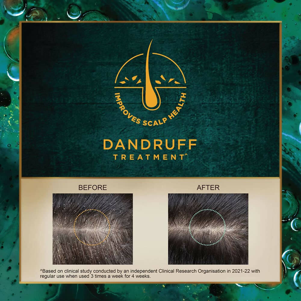 Indulekha Svetakutaja Anti-Dandruff Hair Oil - Indyancart