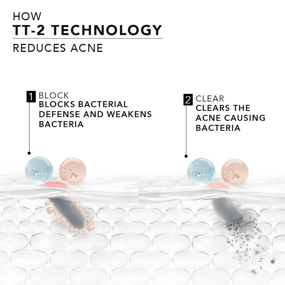 Novology Acne Spot Corrector Gel With 0.1% Thymol + Terpineol - Indyancart