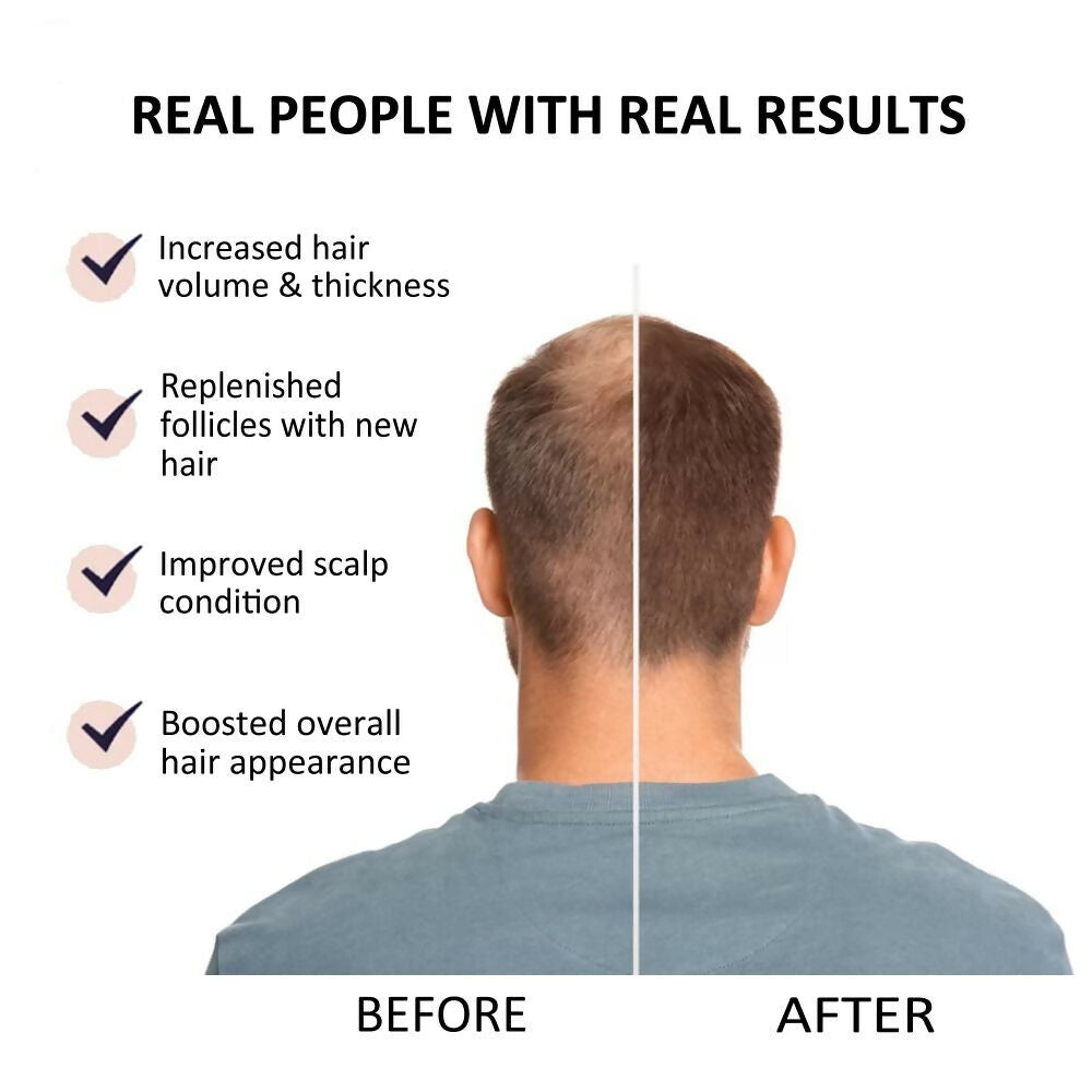 Beauty Secrets Saw Palmetto Hair Growth Serum bottle with dropper, designed for hair care and promoting hair growth.