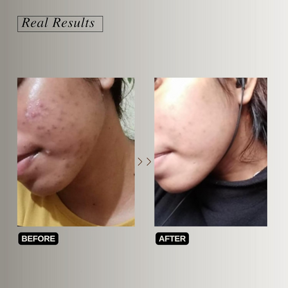 The Formularx Vitamin C Brightening Serum with Arbutin and Nag, featuring a clear bottle with a dropper for glowing skin.