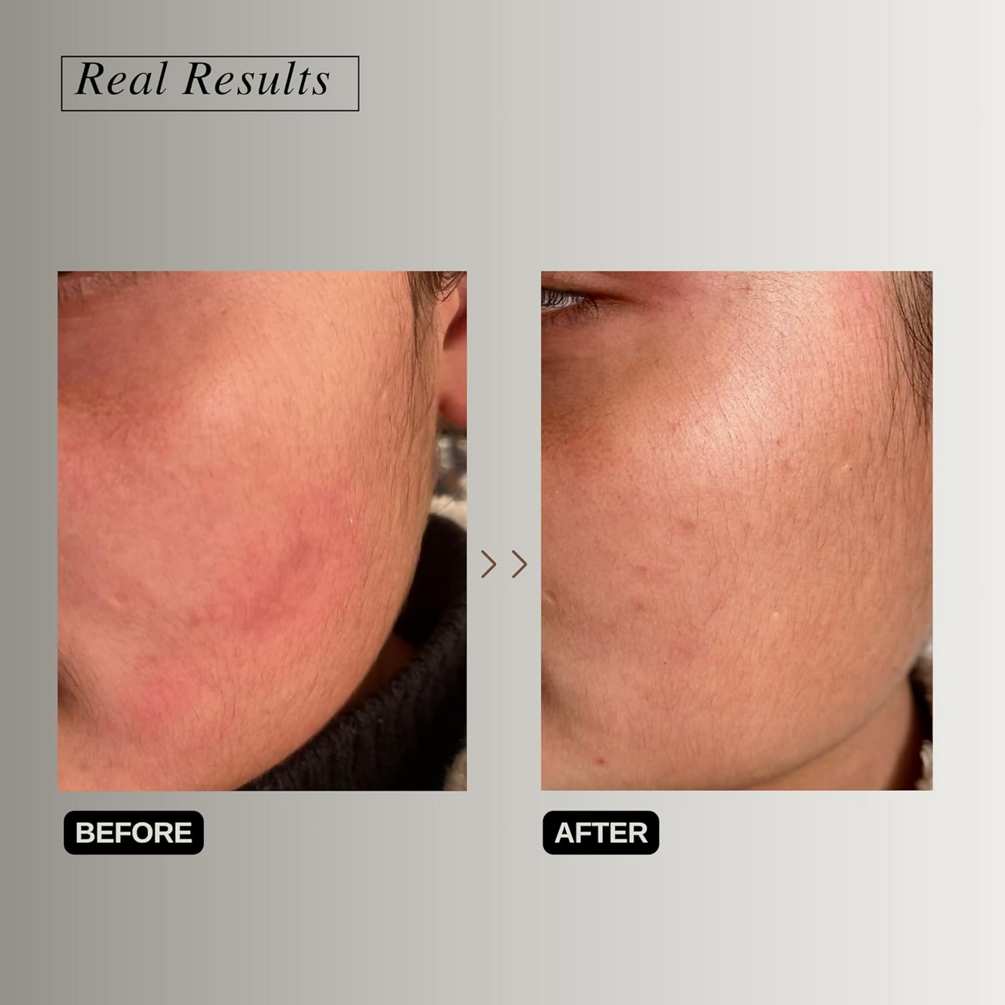 The Formularx Peptide Ceramide Moisturizer Barrier Plus face moisturizer in a sleek jar with a white and silver design.