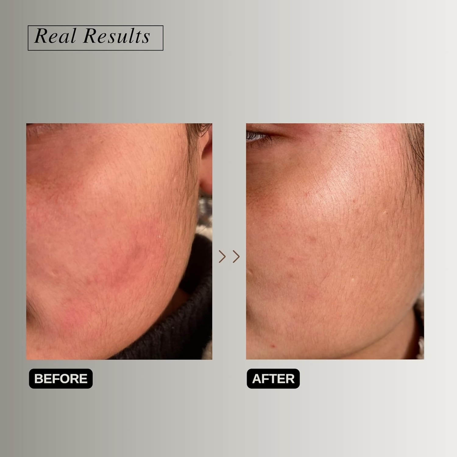 The Formularx Peptide Ceramide Moisturizer Barrier Plus face moisturizer in a sleek jar with a white and silver design.