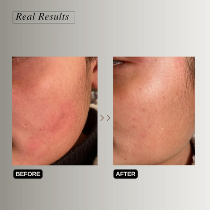 The Formularx Peptide Ceramide Moisturizer Barrier Plus face moisturizer in a sleek jar with a white and silver design.