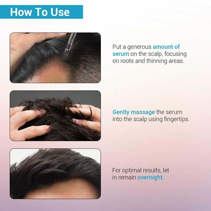 Sotrue Hair Growth Serum With Redensyl 3%, Procapil 3%, Anagain 4% and Baicapil 2% Hair Growth Actives